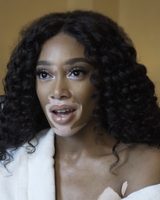 Winnie Harlow